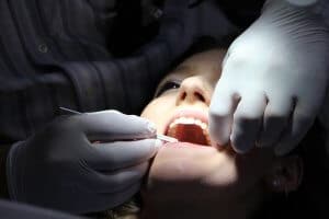 רופא השיניים התרשל במתן טיפול ויפצה ב 185 אלף ש"ח